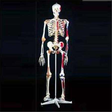 Mr Superskeleton