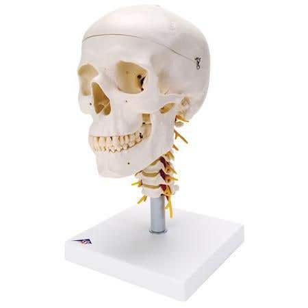 Skull On Cervical Spine - 4 Part