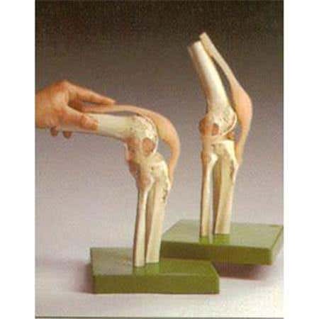 Functional Model Of The Knee Joint