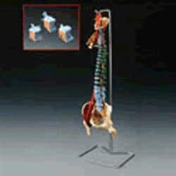 Muscle Spine With Disorders With Stand