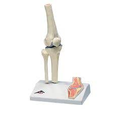 3b Scientific Anatomical Model - Mini Knee Joint With Cross Section Of Bone On Base - Anatomical Model - Mini Knee Joint With Cross Section Of Bone On Base