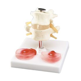 Budget Lumbar Vertebrae with Interchangeable Discs