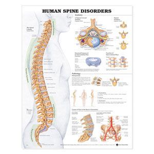 Human Spine Disoders 20 X 26 Laminate