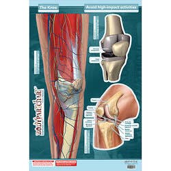 BodyPartChart™ The Knee 24” x 33.5”