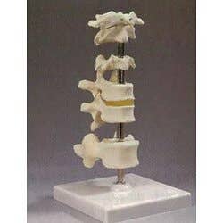 Vertebrae
